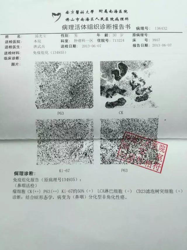 原始点调理鼻咽癌三期放化疗后遗症：细节决定效果