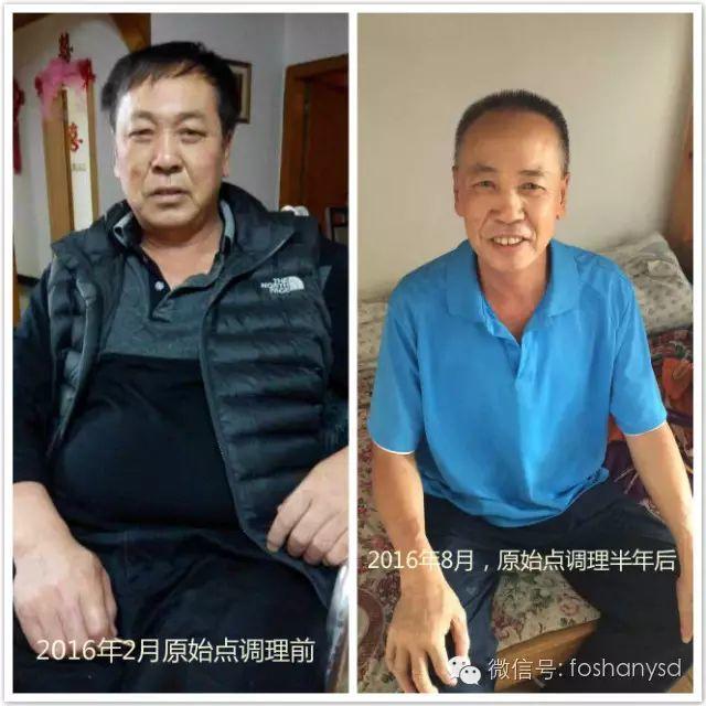 触目惊心 原始点调理八年病史牛皮癣，半年基本恢复健康