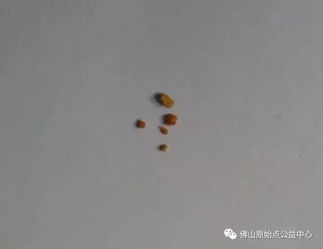 本中心学员花开深圳，原始点调理，先后自然排出肾结石