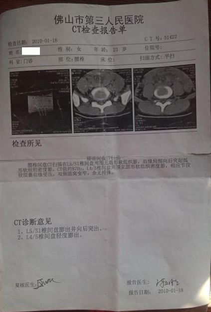 七年的腰椎间盘突出 用原始点不到一年 好了 七年的腰椎间盘突出 用原始点不到一年 好了