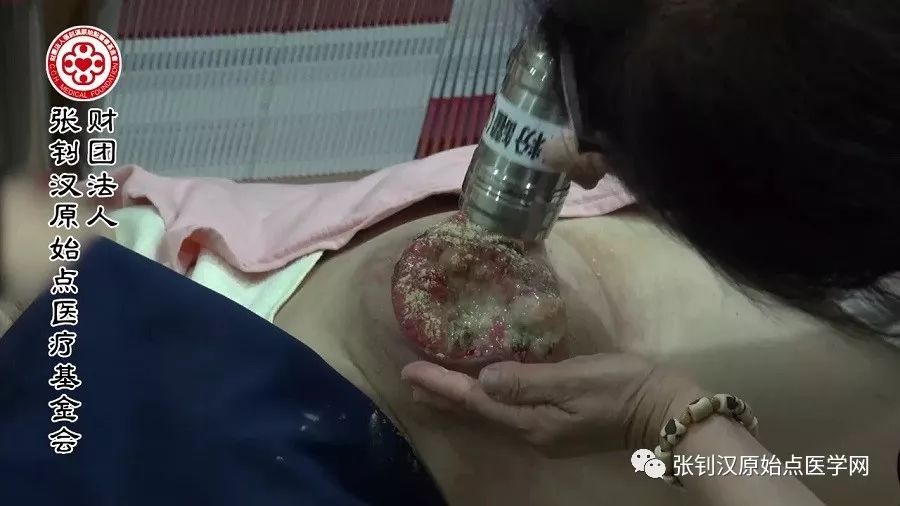 乳癌处理注意事项