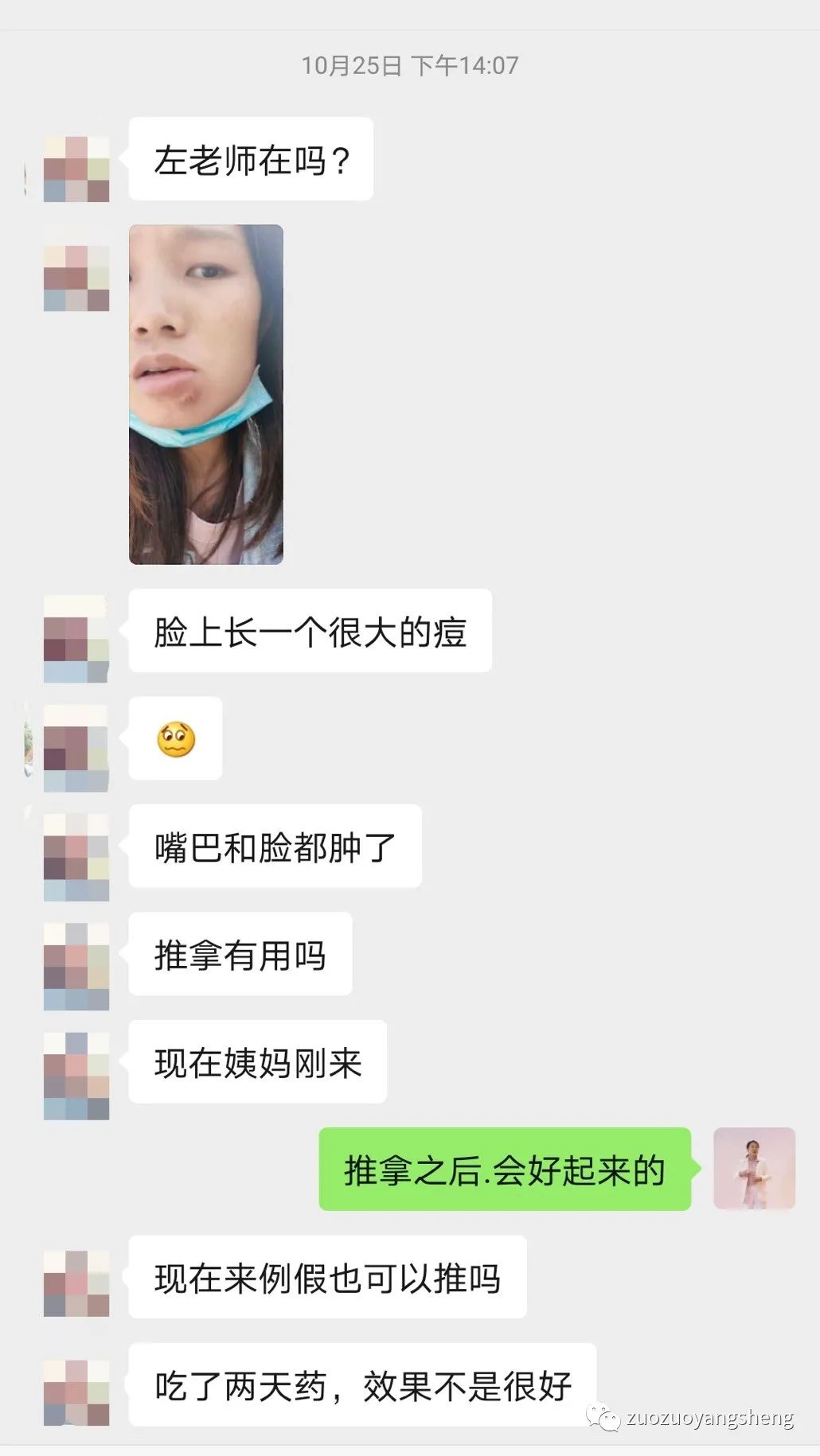 案例分享：原始点调理下巴长痘，咬肌发炎肿大的案例