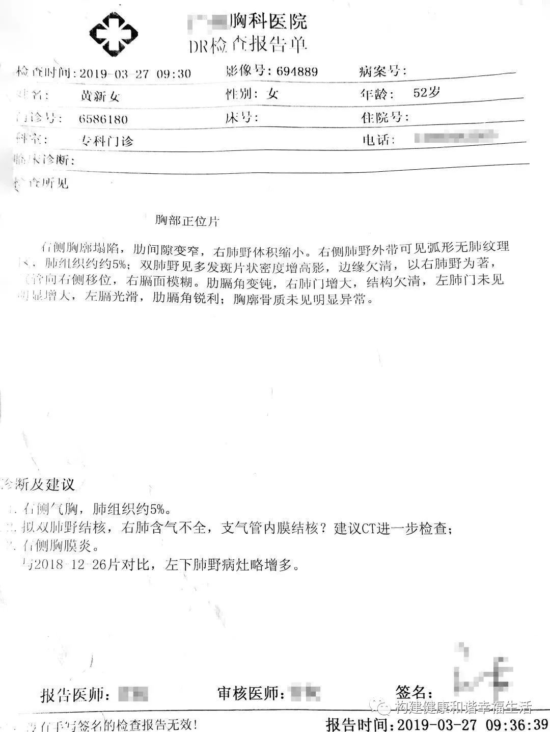 原始点调理肺结核综合症案例