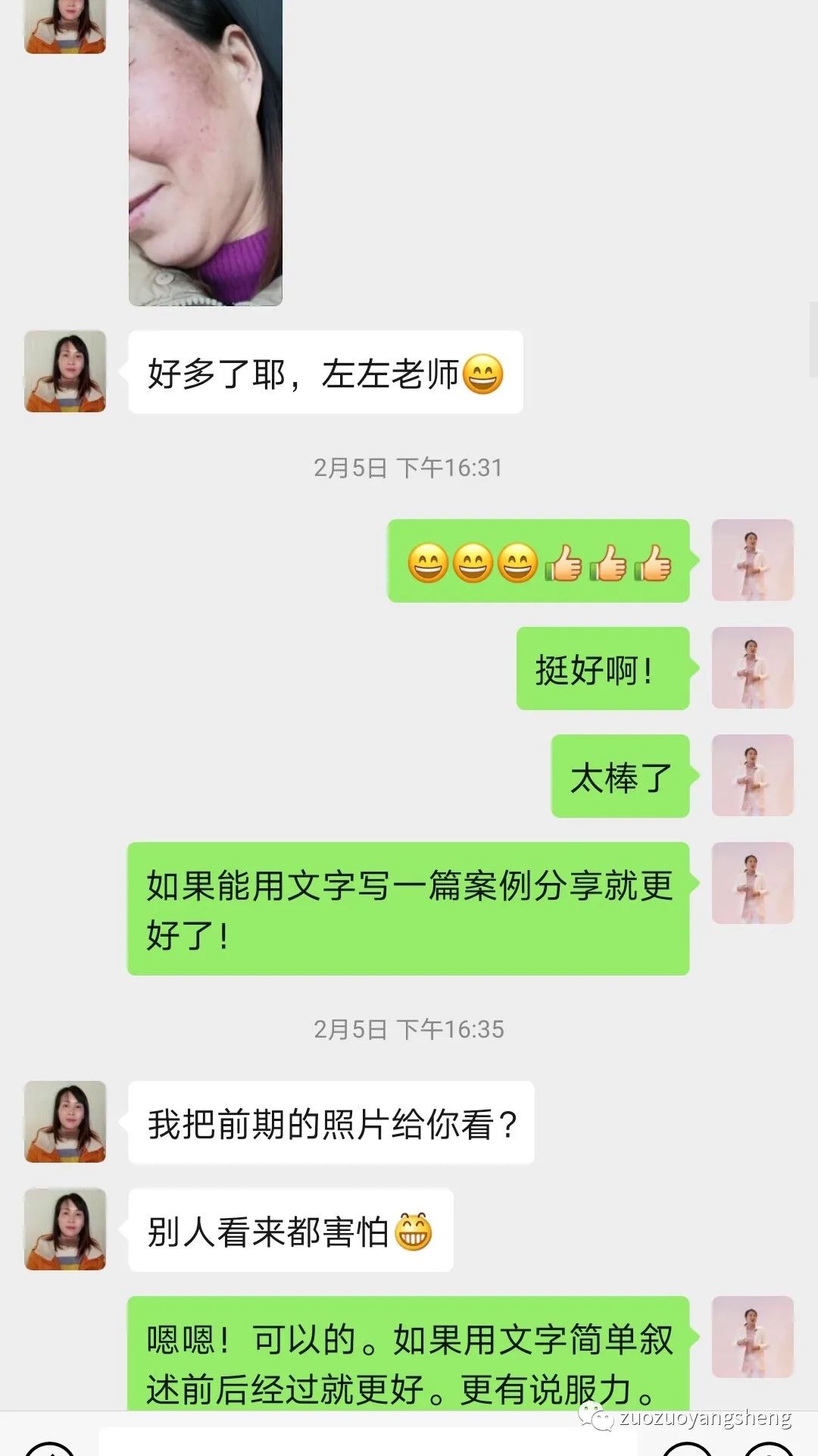 案例分享：原始点调理脸部严重过敏案例