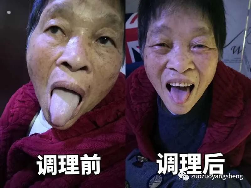 案例分享：原始点调理70岁老人腹痛（医院诊断可能升结肠癌）、飞蛾症、腿抽筋、失眠的案例