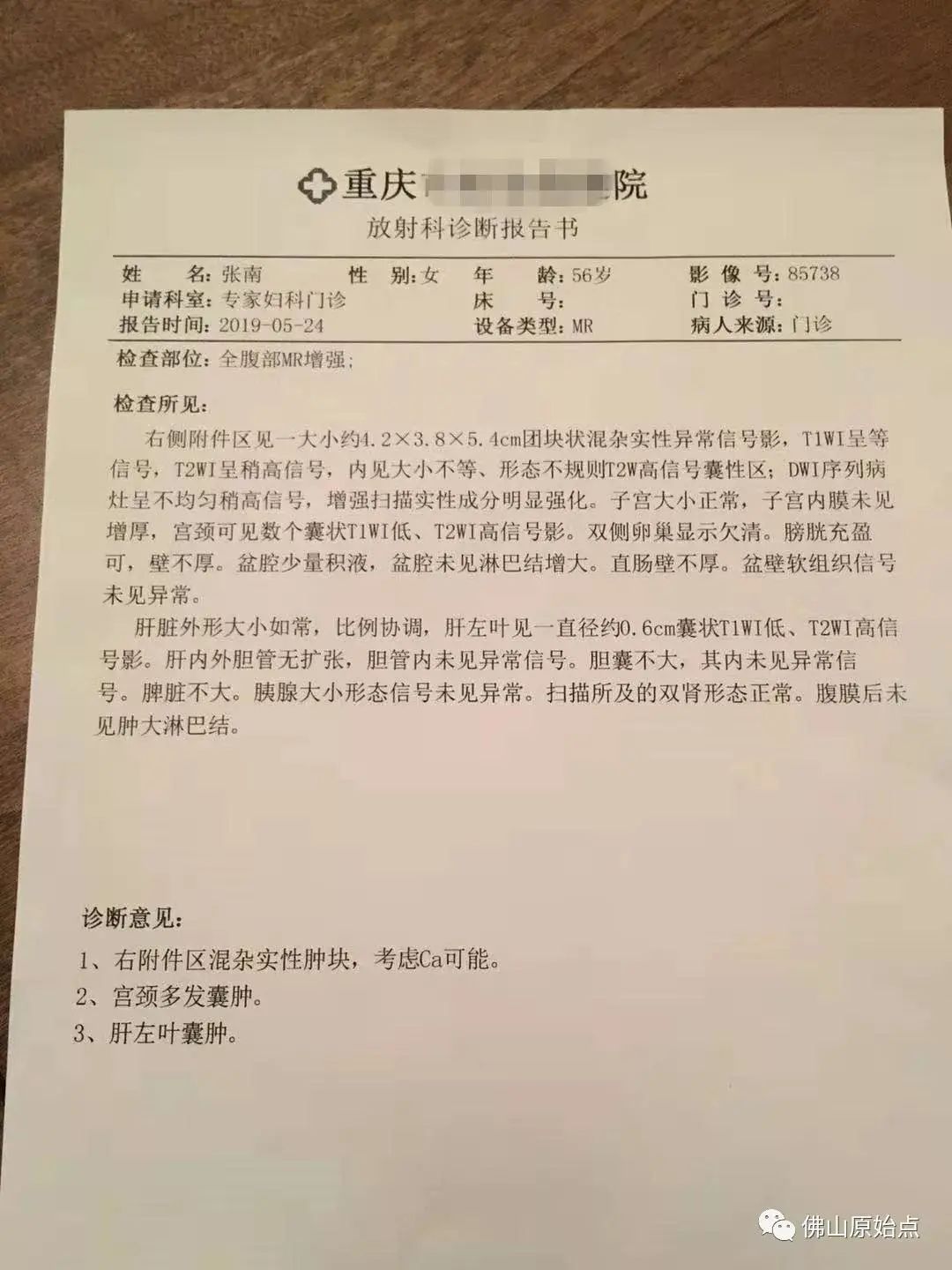 原始点调理附件肿瘤案例