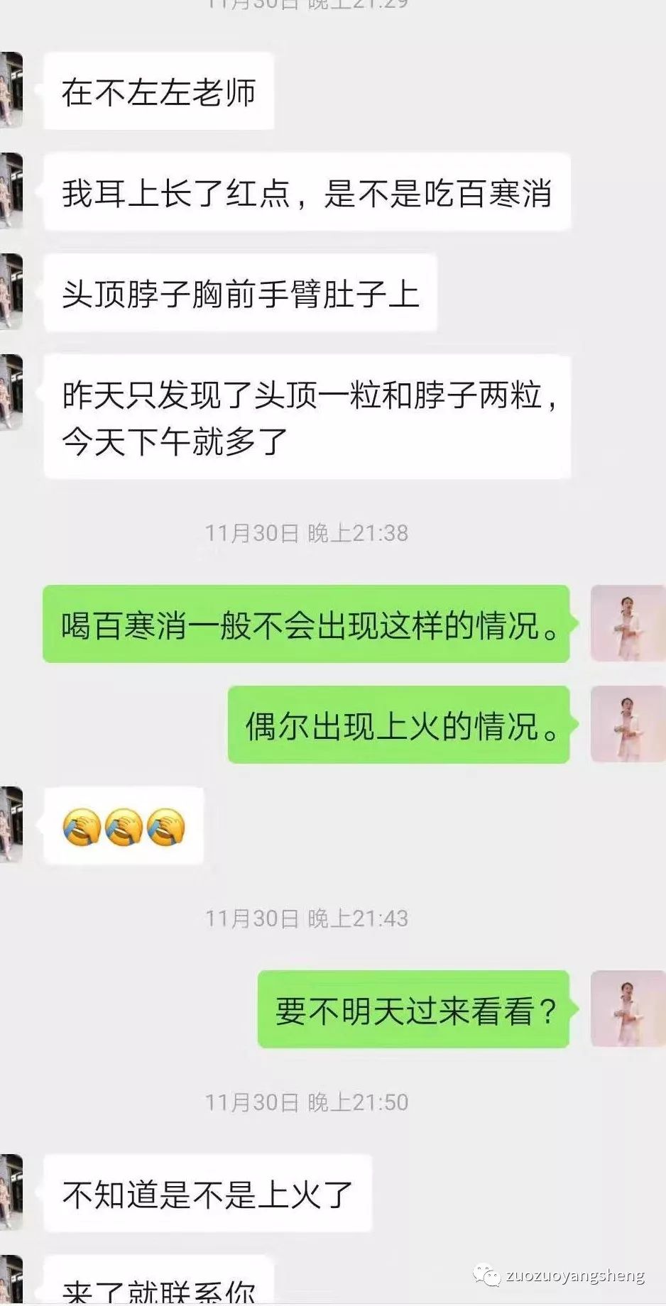 案例分享：原始点调理成人水痘案例