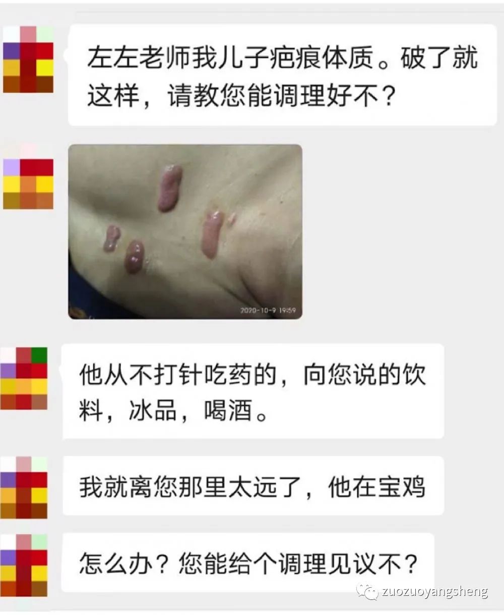 微问答195期：我弟弟尿尿是红色的，检查后医生怀疑是尿结石，该怎么办？