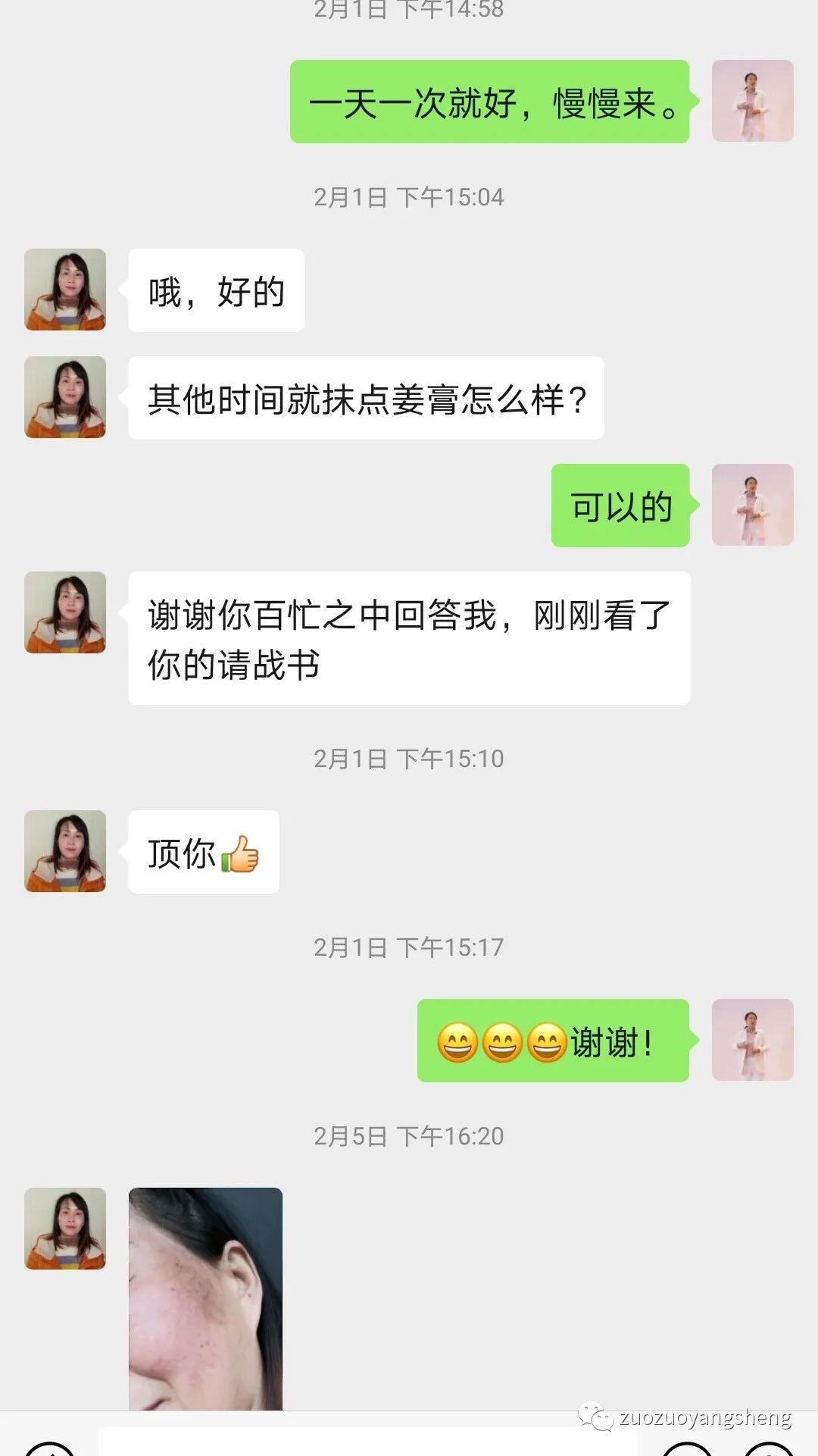 案例分享：原始点调理脸部严重过敏案例