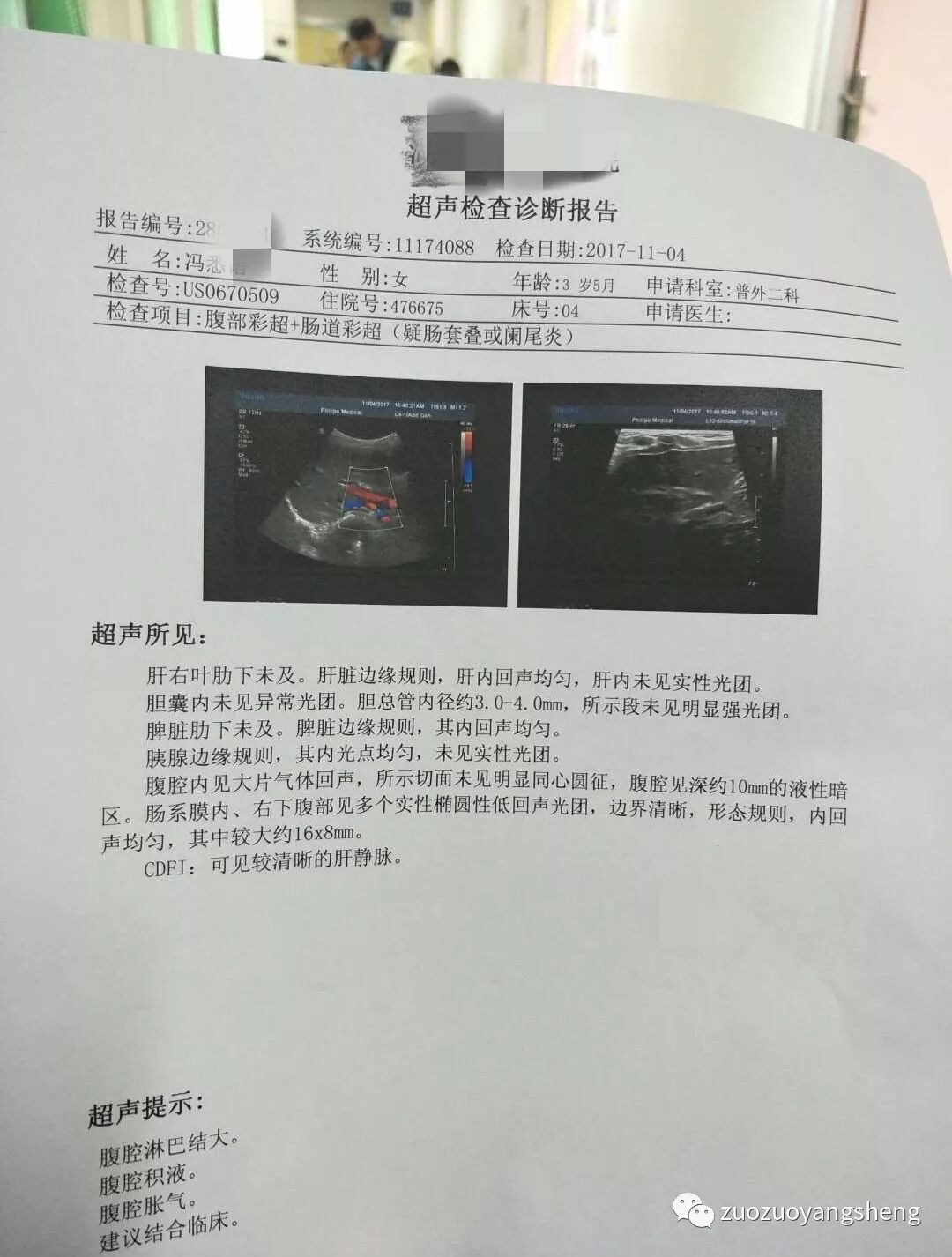 案例分享：原始点调理孩子胃疼、便秘的案例