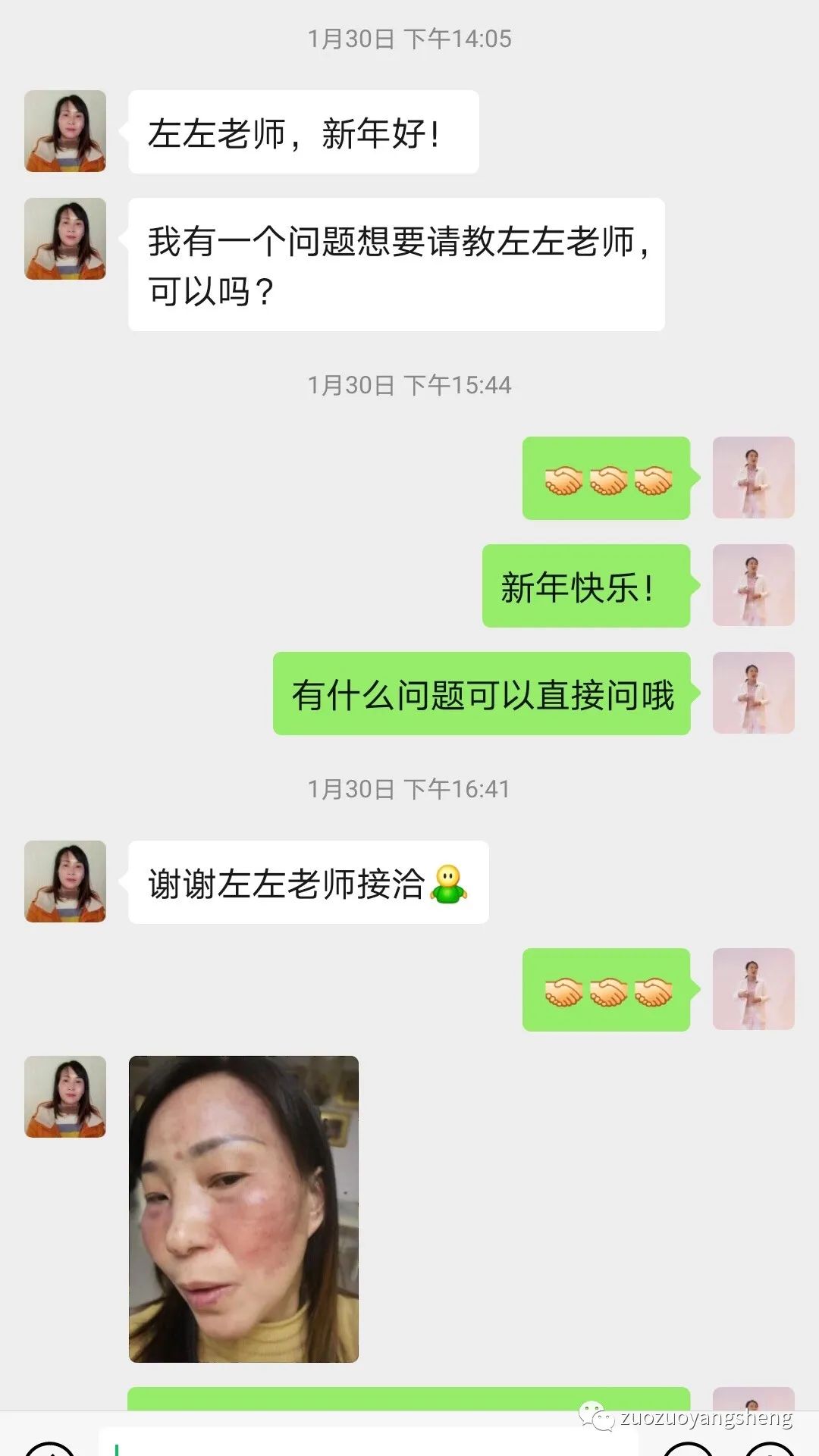 案例分享：原始点调理脸部严重过敏案例