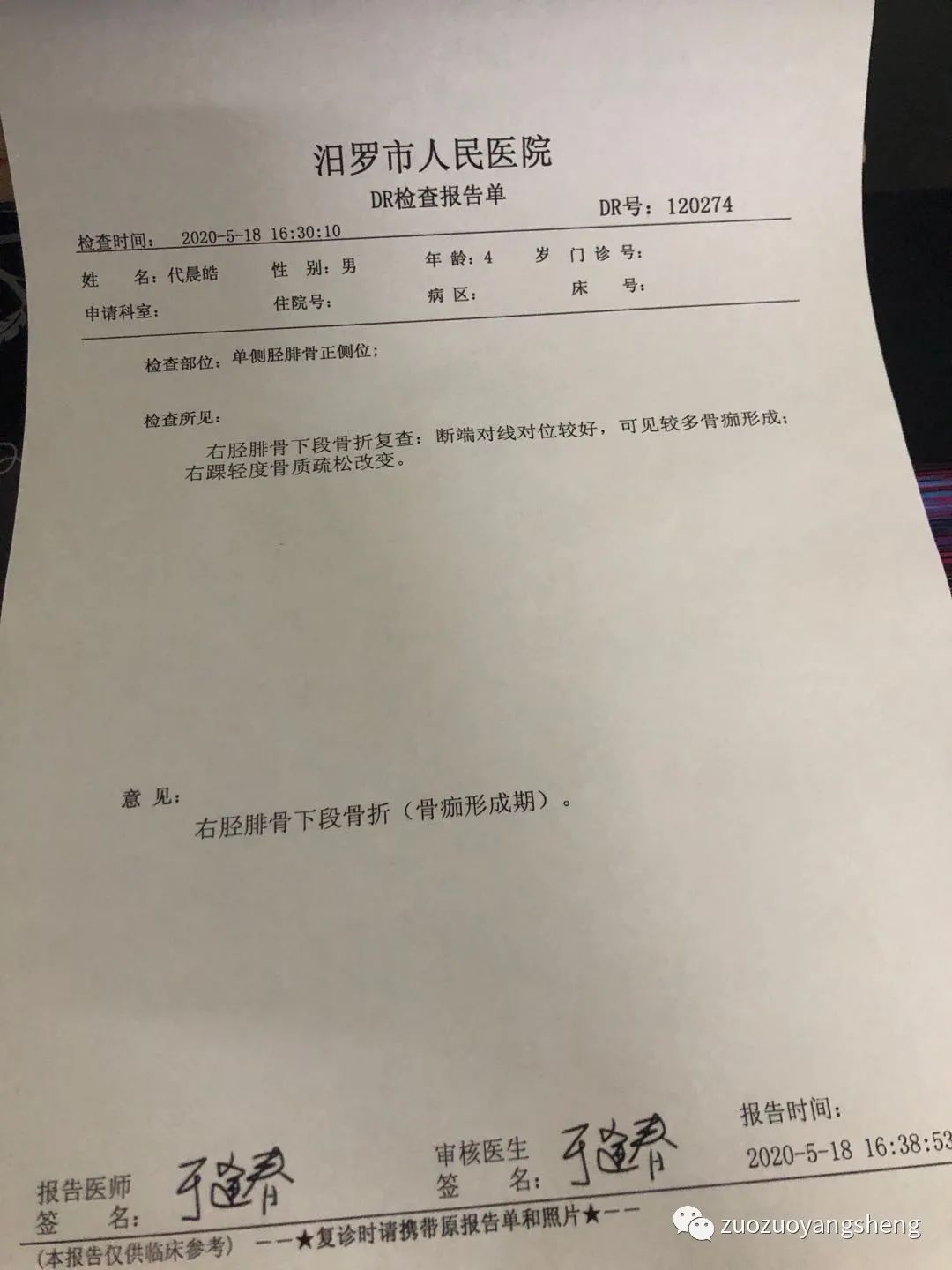 案例分享：原始点调理3岁小孩右腿骨折案例