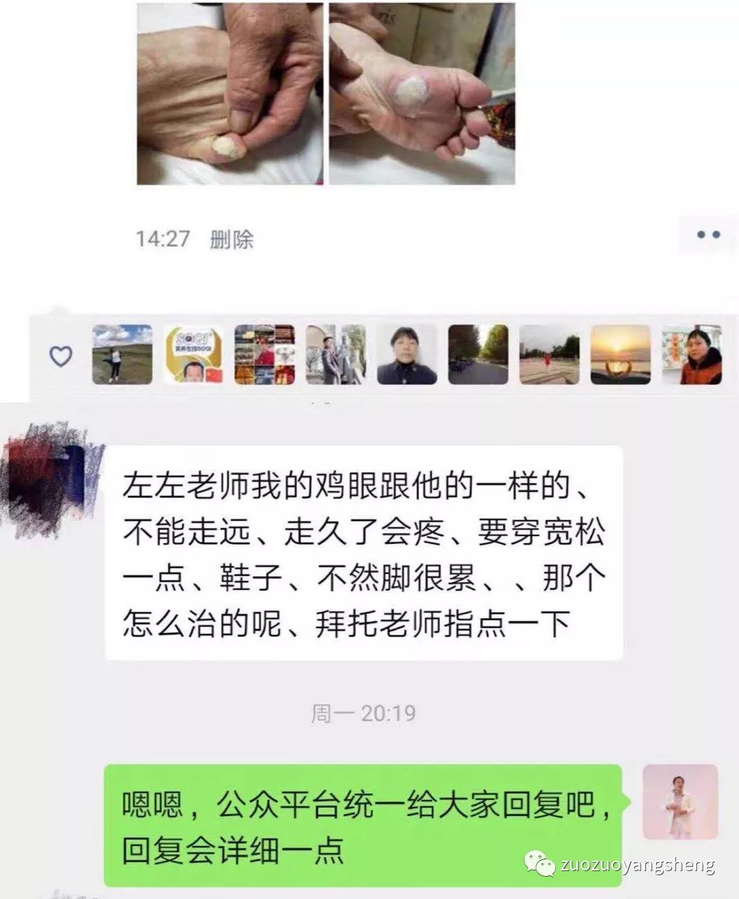 微问答159期：“鸡眼”用原始点怎么调理？