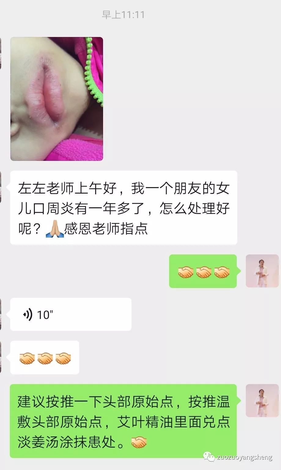 微问答141期：如何让全家人配合原始点调理孩子过敏性鼻炎？