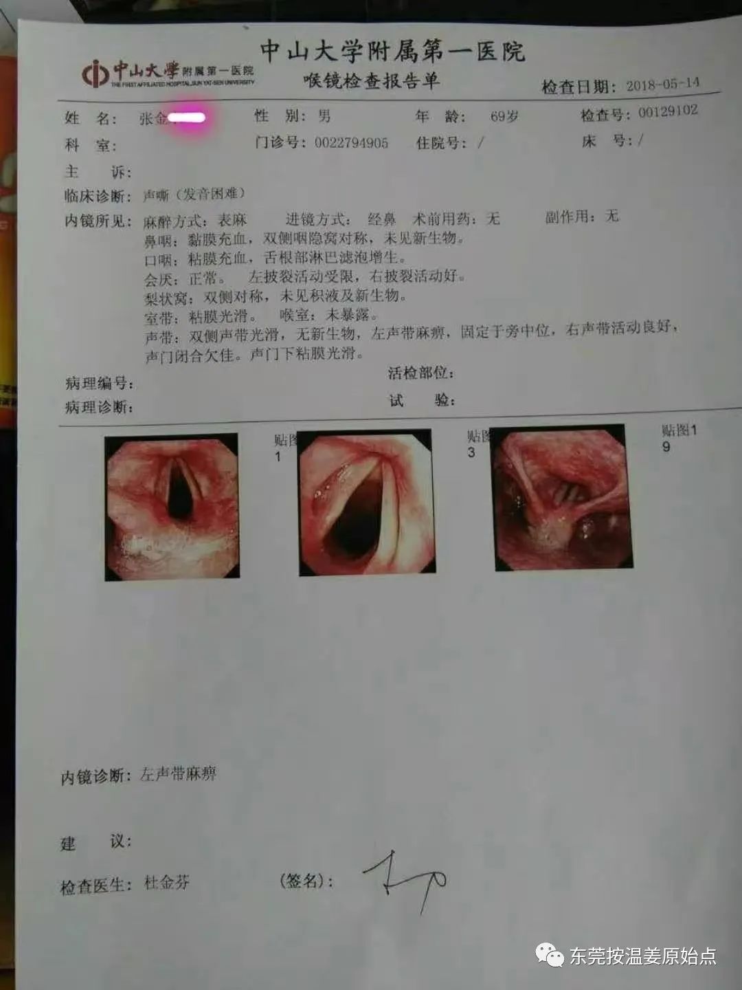 声带麻痹，说话费力、沙哑，咽痛