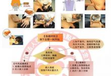 脑中风、癫痫、心脏病之院前急救。原始点复苏术  OPR (Origin Point Resuscitation)-原始点全球同学网