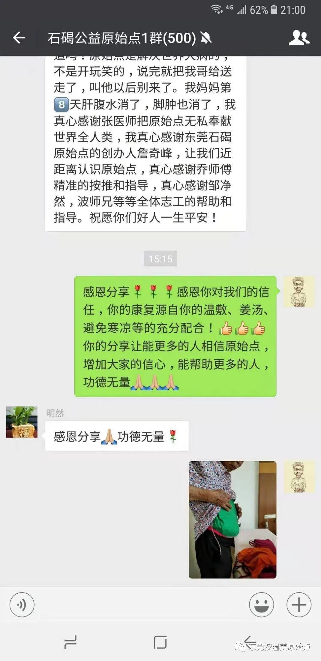 肝硬化肝腹水，双腿小肿，用原始点十天消肿