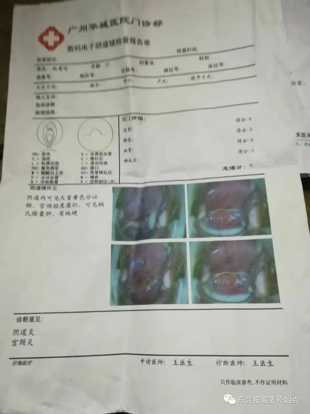 严重妇科病：阴道炎，宫颈炎，盘腔积液