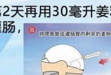 姜粉泥灌肠两周治好30多年肠沾黏案例-原始点全球同学网