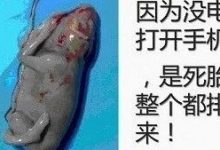 怀孕19周胎死腹中案例-原始点全球同学网