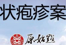 李先生2021年带状疱疹案例 日期：2021/3/13-原始点全球同学网