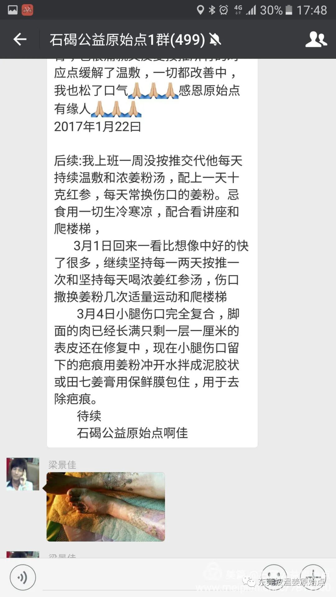 高血糖，双腿腐烂不愈合，西医认为需截肢