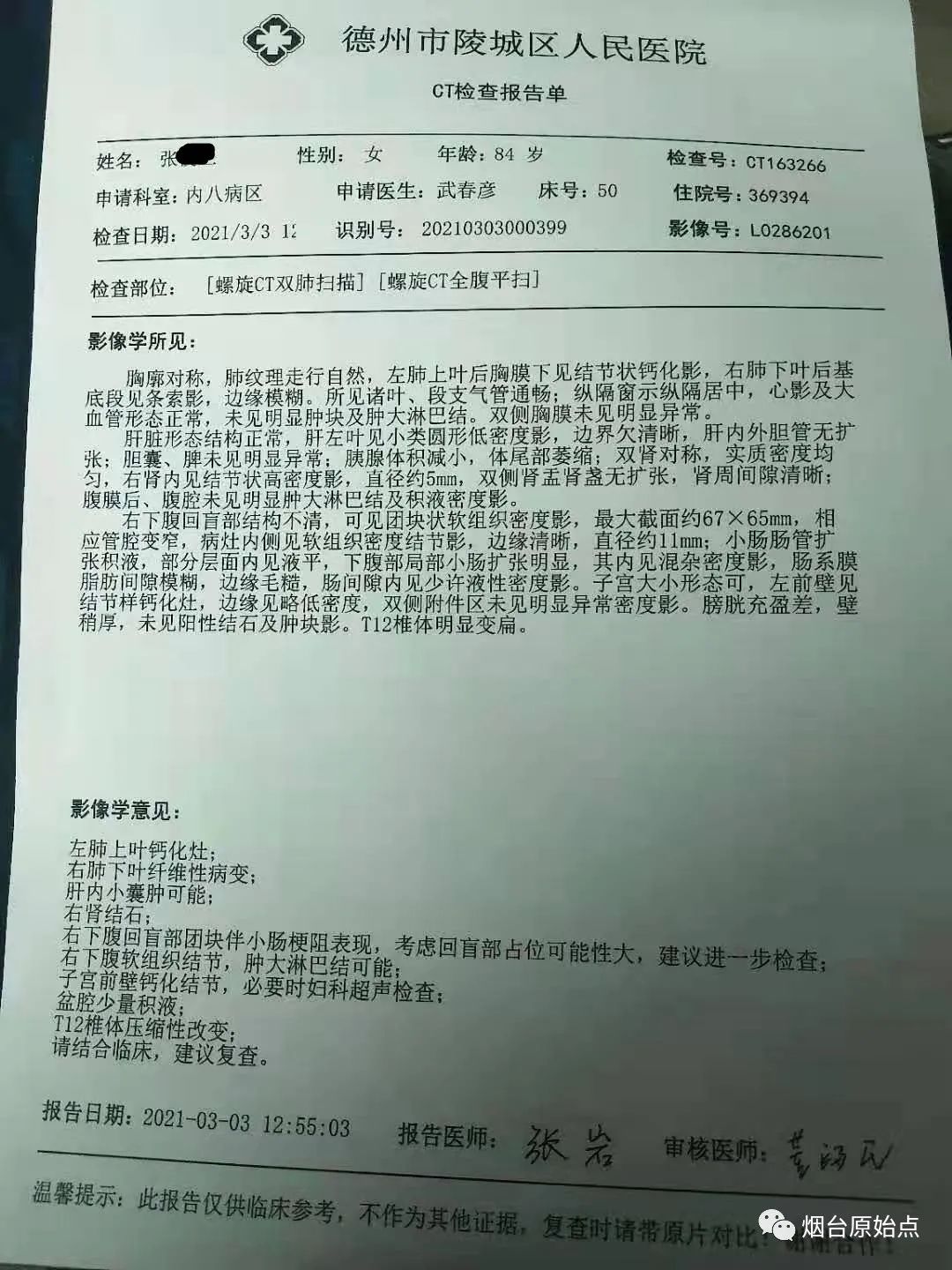 84岁结肠瘤，排便受阻案例