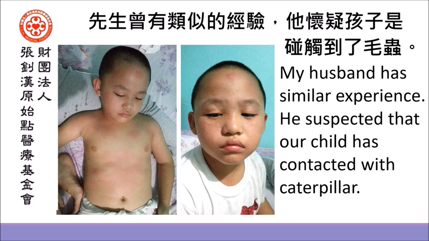 疑似毛虫虫过敏案例 (马来西亚) Suspected Allergy Due To Caterpillar (Malaysia)-2019年7月1日-原始点全球同学网