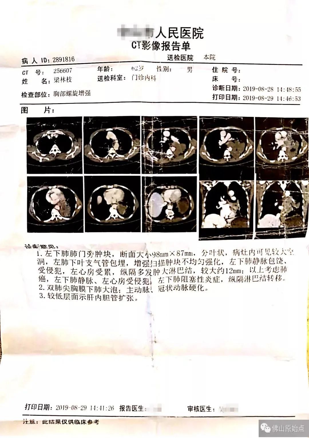 原始点调理肺癌晚期案例---感恩遇见