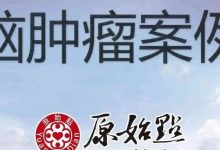 58岁刘女士脑肿瘤案例-2019年12月接受调理18天，各种症状改善8-9成..-原始点全球同学网