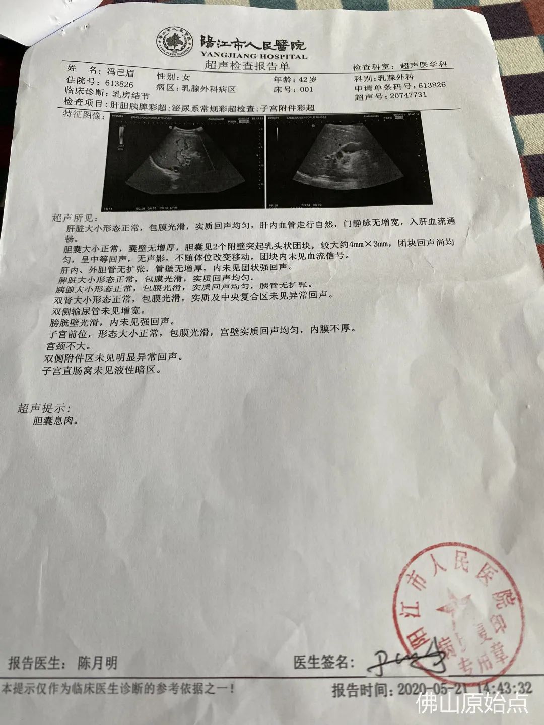 原始点调理乳腺恶性肿瘤切除术后身体多处疼痛案例