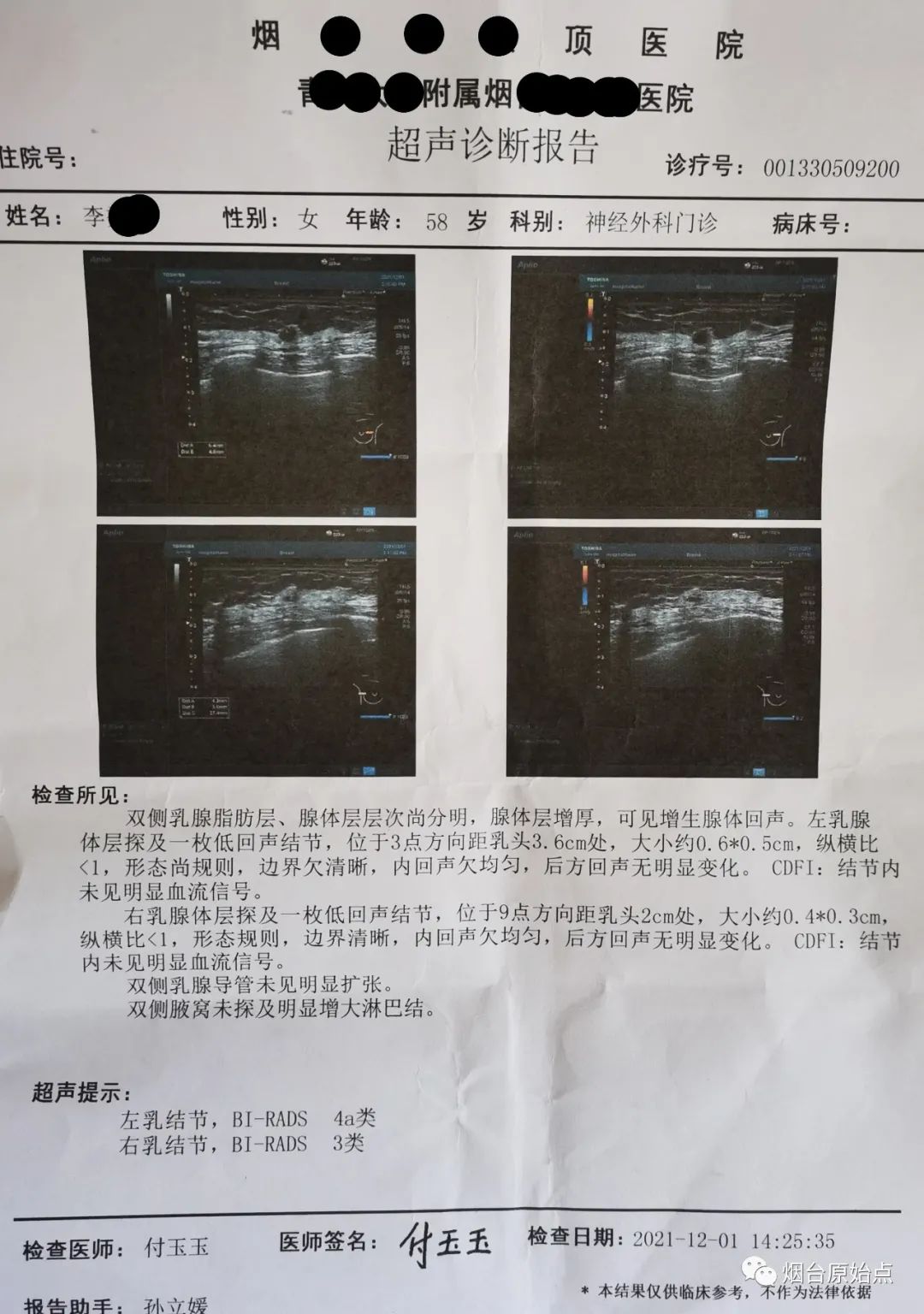 乳腺结节案例