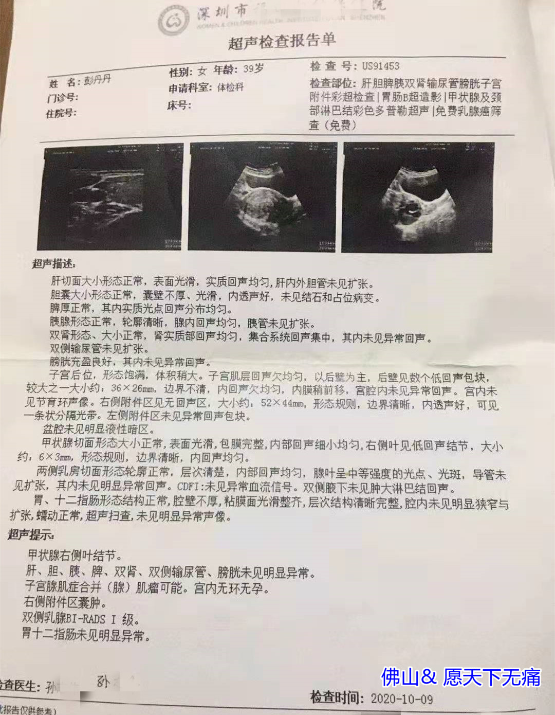 原始点调理子宫腺肌症 痛经案例 - 妇产 - 佛山愿天下无痛