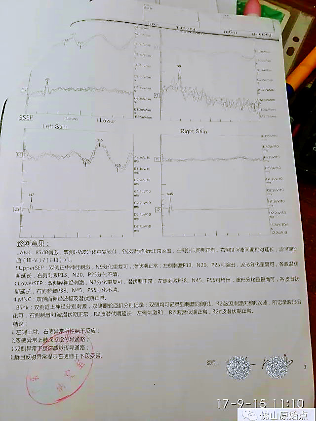 原始点调理脑胶质瘤：告别风雨见阳光——向超 - 头颈部癌症与肿瘤 - 佛山市愿天下无痛健康管理服务有限公司-原始点全球同学网