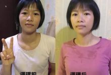 案例分享：学员李女士学习与践行自然疗法的心路历程-原始点全球同学网