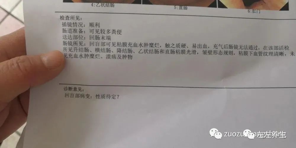 案例分享：70岁老人腹痛（医院初诊可能升结肠癌）飞蛾症、腿抽筋、失眠调理案例