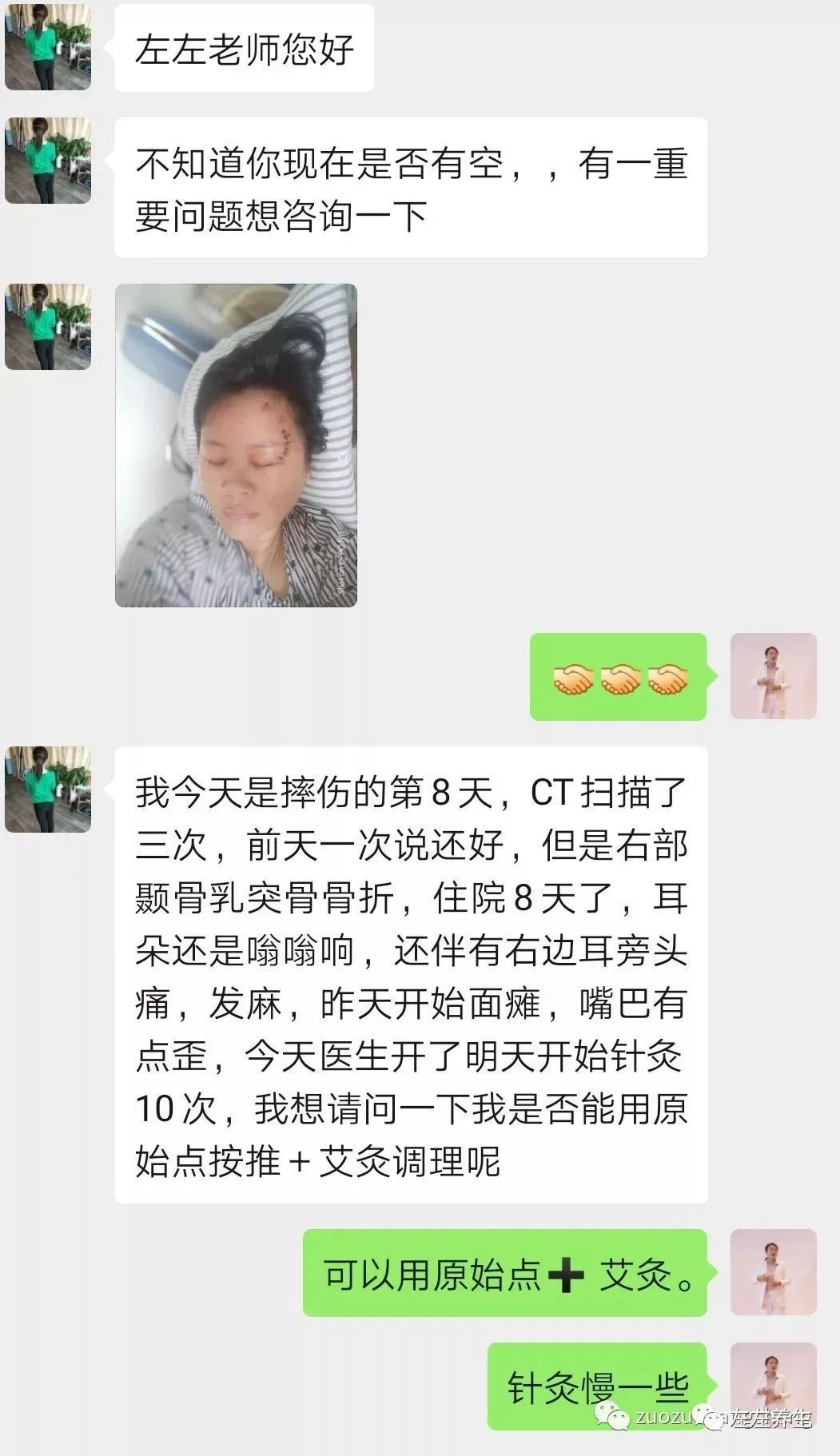 案例分享：车祸导致面瘫调理案例