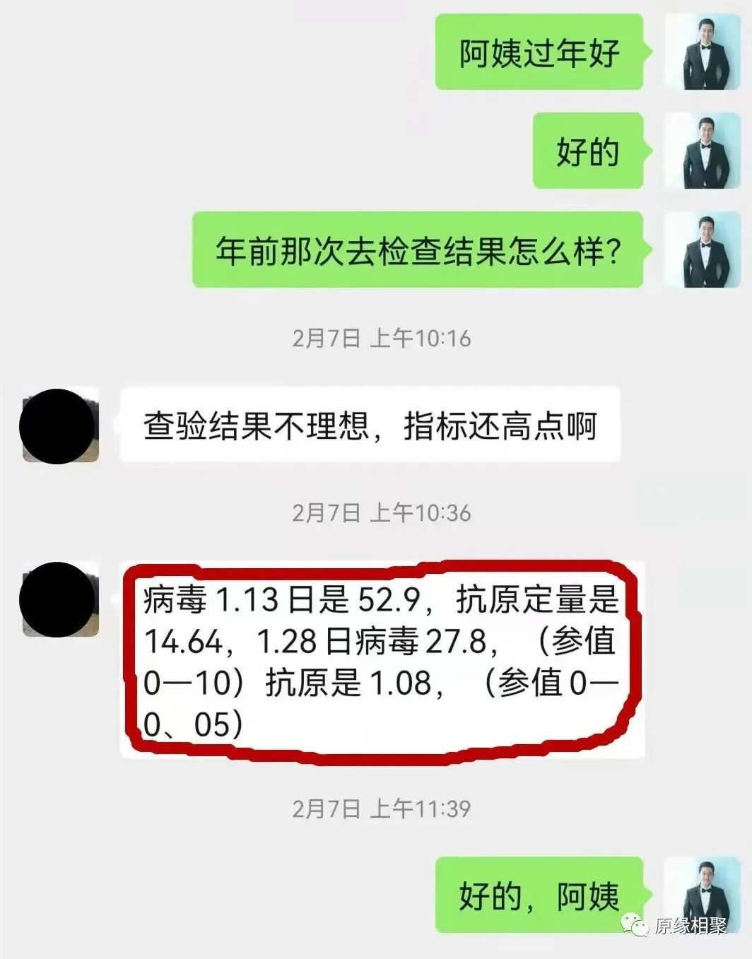 急性乙肝病毒