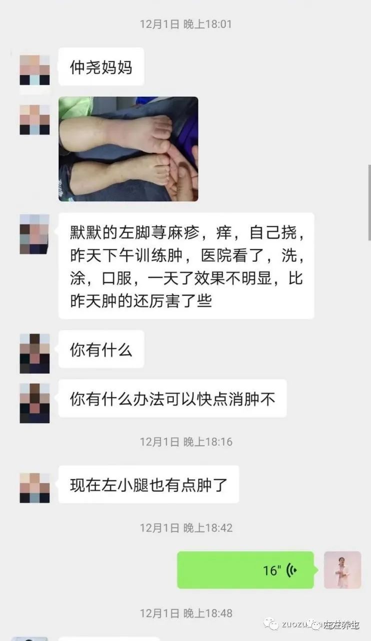 案例分享：原始点调理小孩荨麻疹调理案例