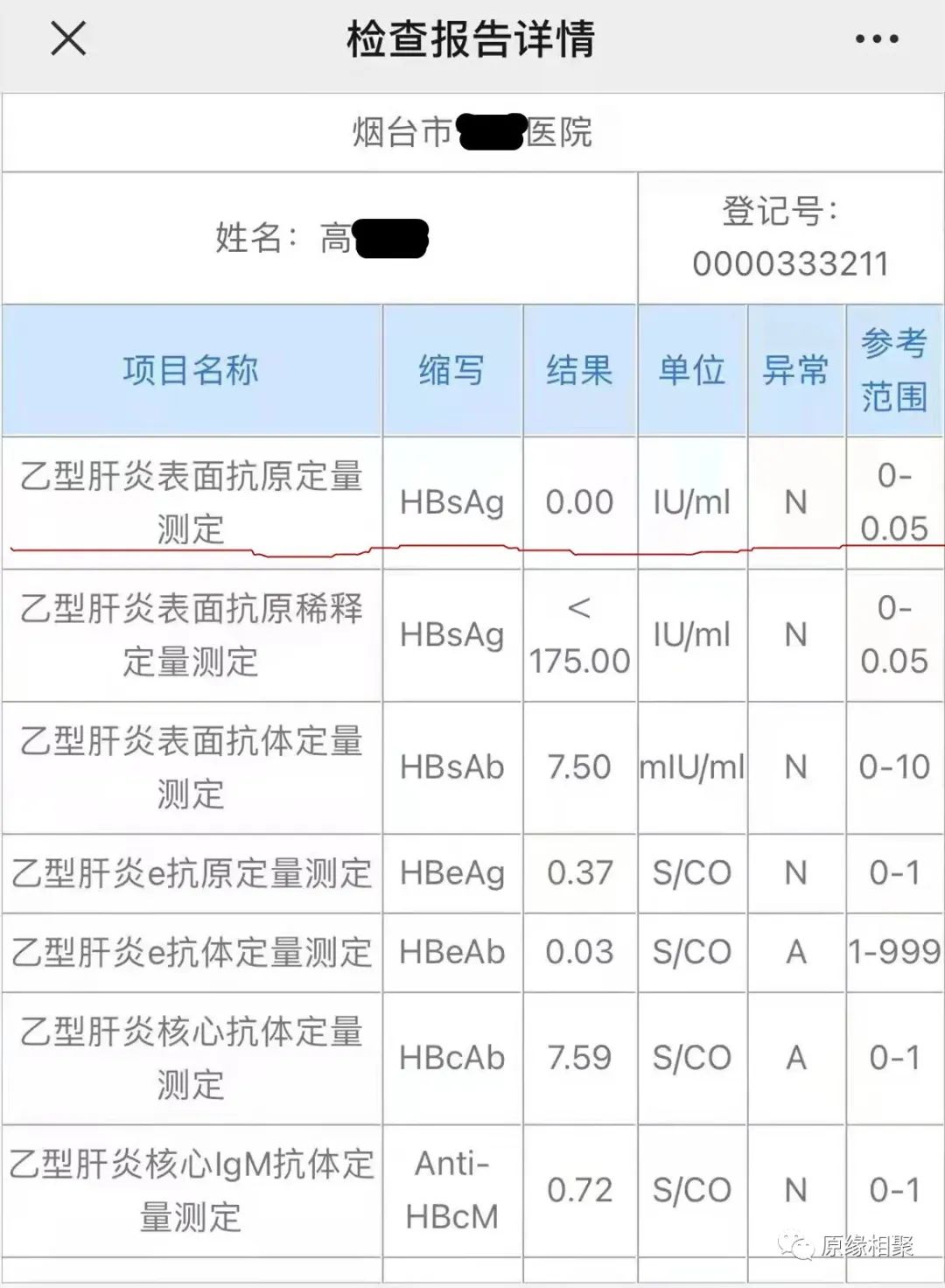 急性乙肝病毒