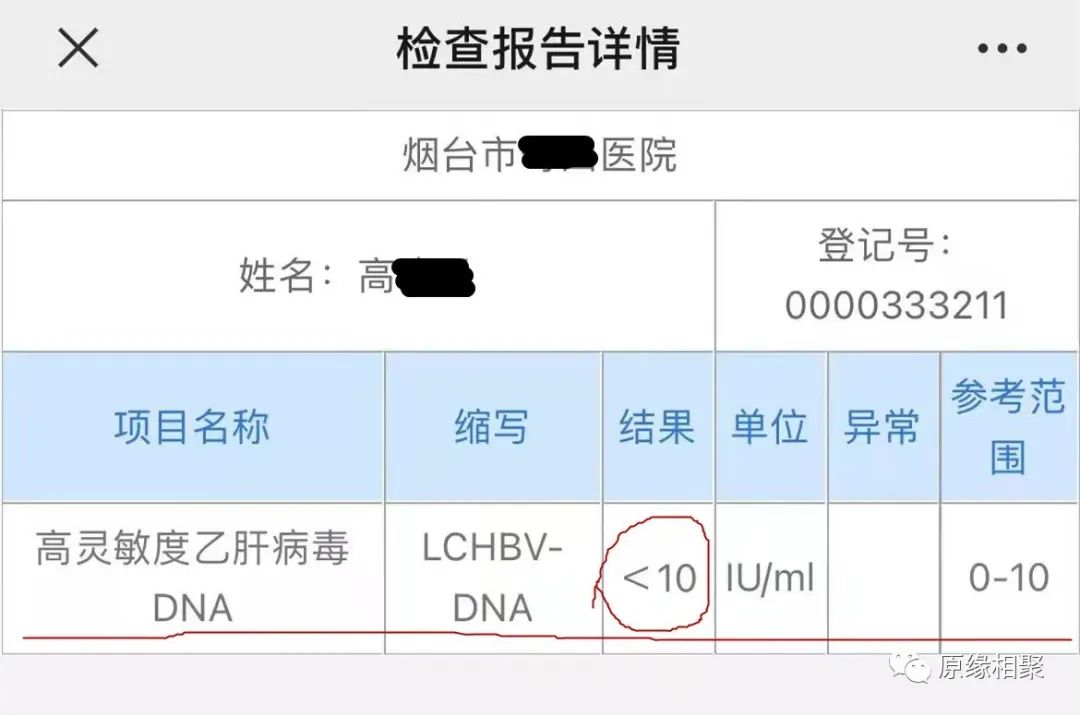 急性乙肝病毒