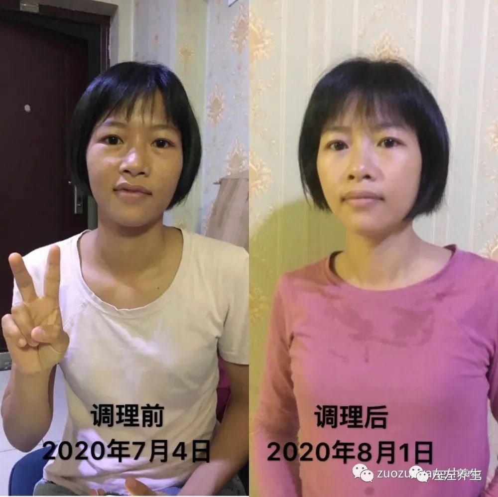 案例分享：学员李女士学习与践行自然疗法的心路历程