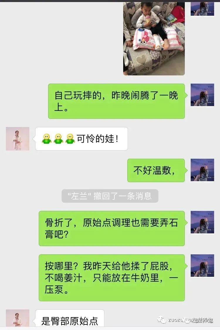 案例分享：三岁孩子右腿骨折调理案例