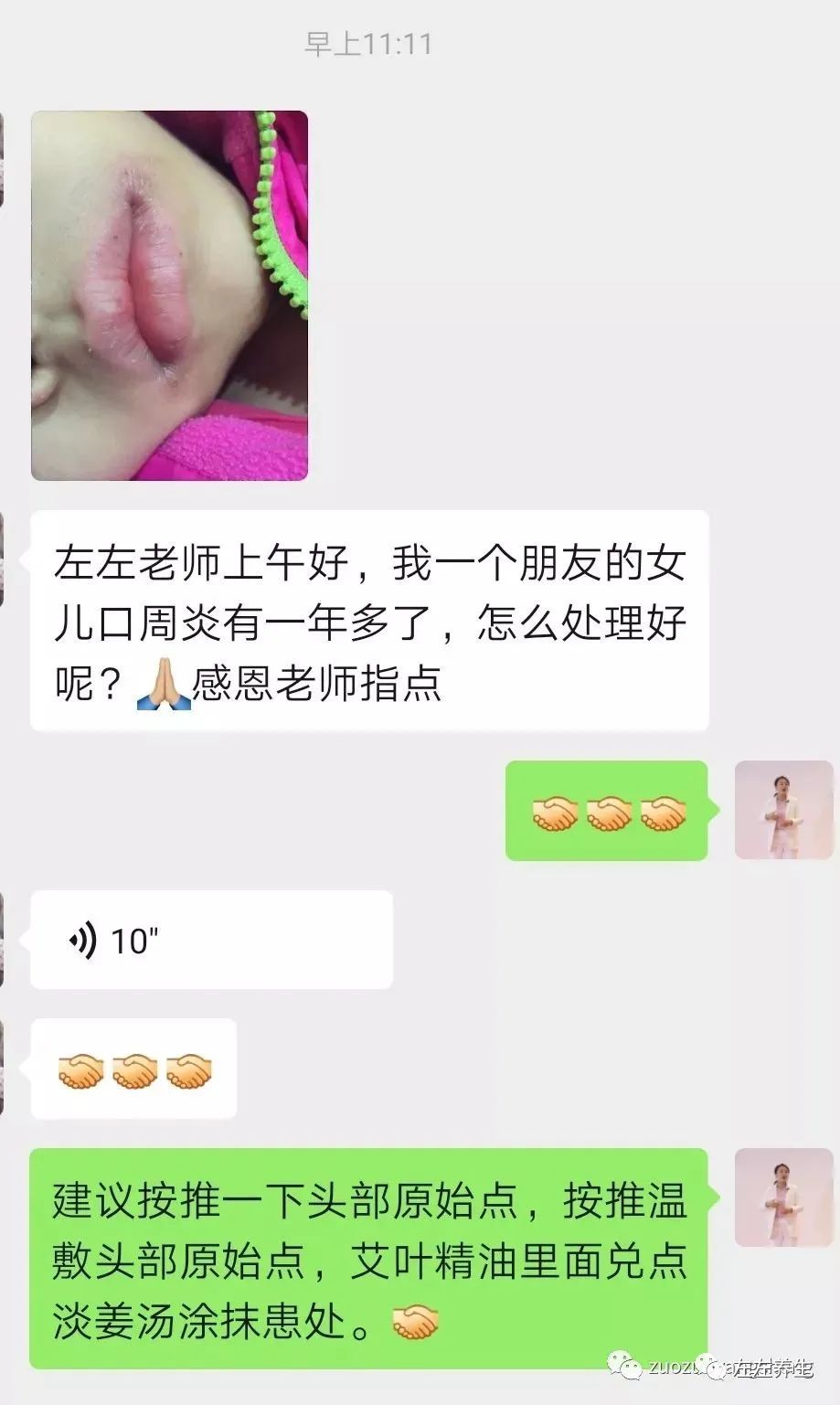 微问答56期：如何让家人配合调理孩子过敏性鼻炎？