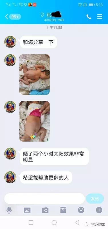 婴儿黄疸怎么办？方法竟然如此简单！