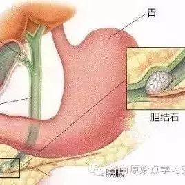 癌中之王“胰腺癌”的康复与失败-原始点全球同学网